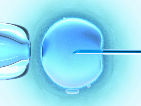 in vitro fertilization image 