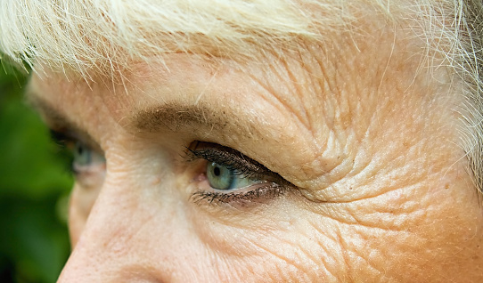 Photo of wrinkles around eye  of an older woman