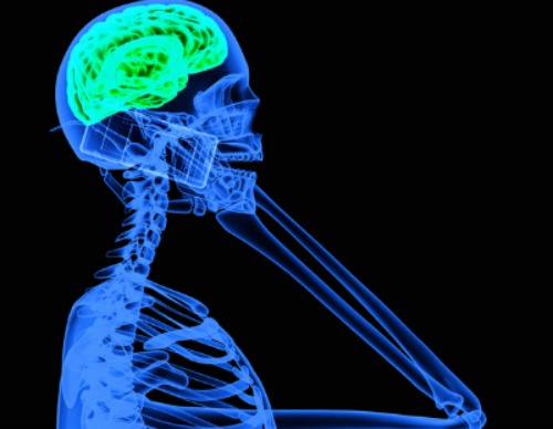 X-ray of a person holding a cellphone with brain highlighted 